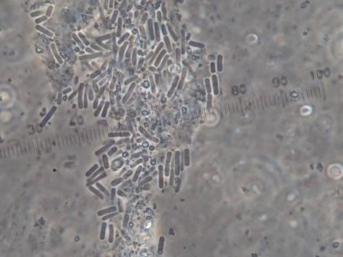 Olivia Araya clostridiosis